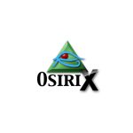 OsiriX