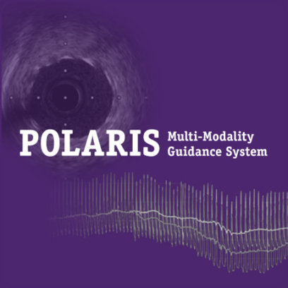 IVUS Polaris Guidance System
