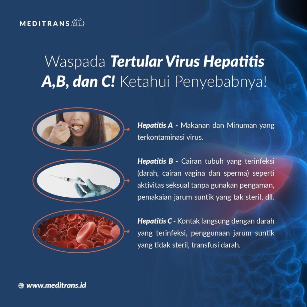Waspada Tertular Hepatitis A, B, dan C: Penyebab dan Pencegahannya