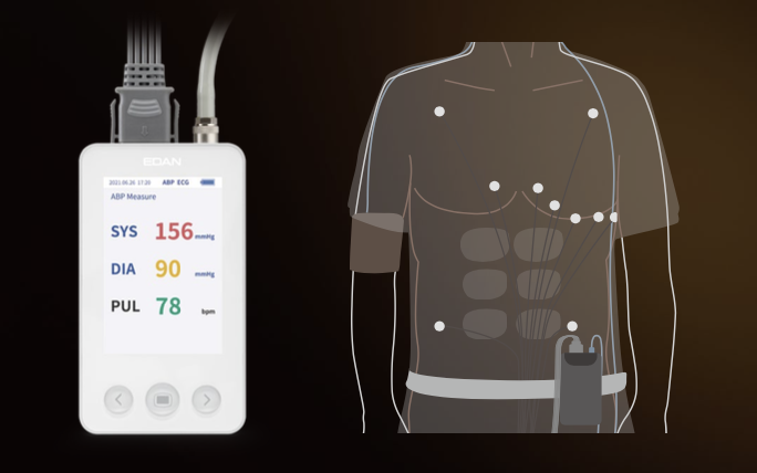 Holter ECG and Ambulatory Blood Pressure SA-20