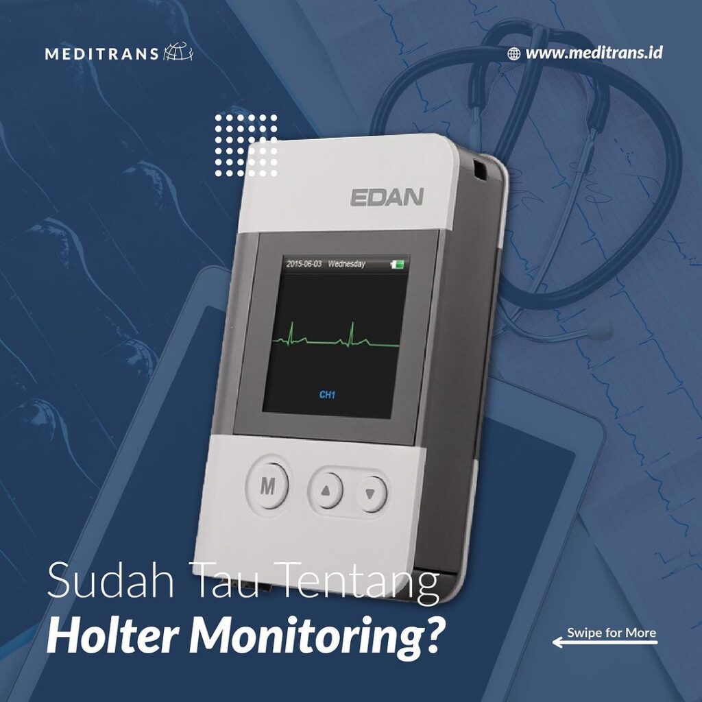 Holter Monitor: Merekam Detak Jantung Untuk Pengawasan Yang Lebih Lama